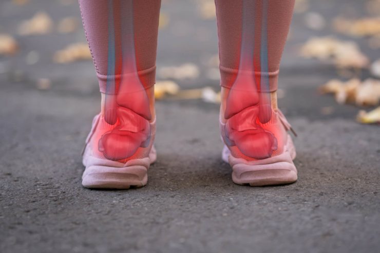 Pieds plats orthopédie semelles NF otho Bulle